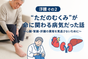 浮腫 その２｜“ただのむくみ”が命に関わる病気だった話